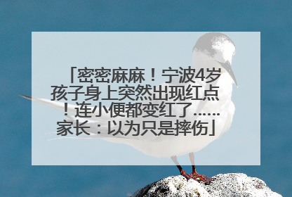 密密麻麻！宁波4岁孩子身上突然出现红点！连小便都变红了……家长：以为只是摔伤